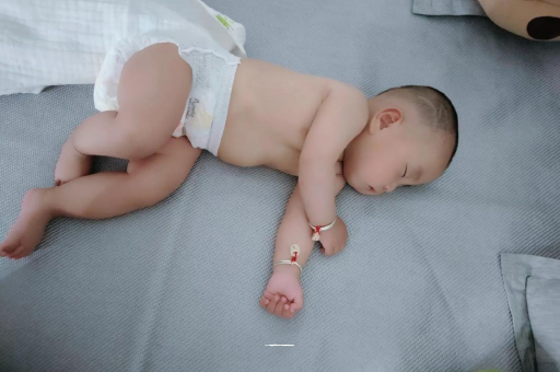 任丘六个月宝宝眼睛散光